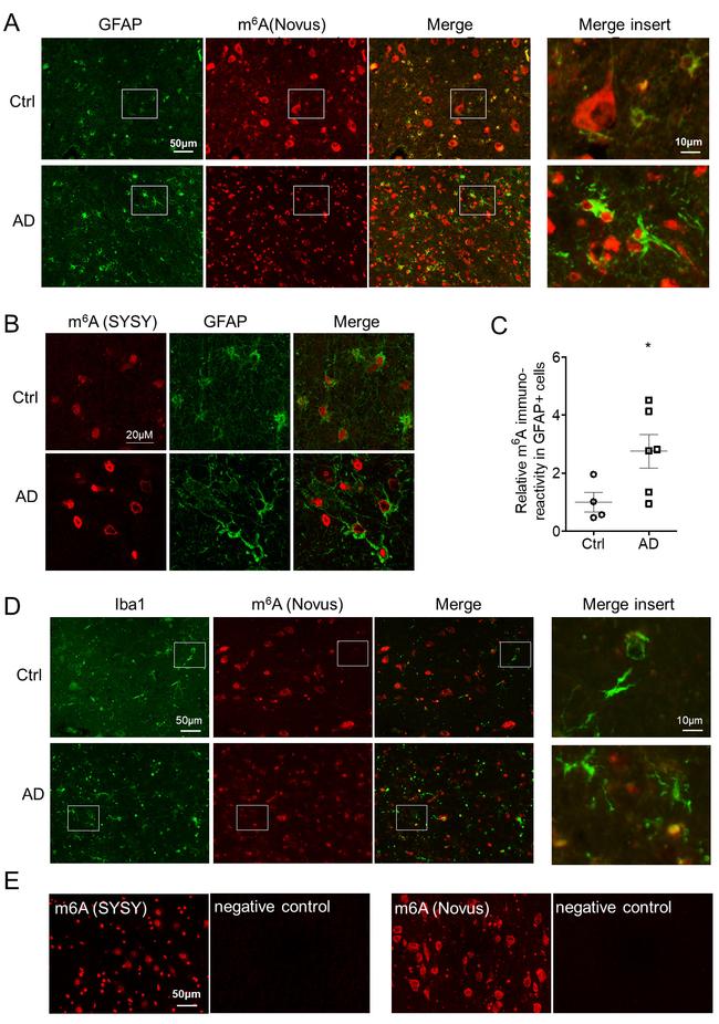 IBA1 Antibody in Immunohistochemistry (Paraffin) (IHC (P))