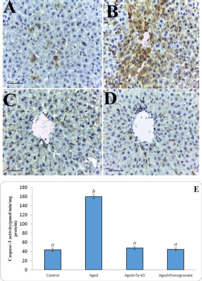 p53 Antibody in Immunohistochemistry (IHC)