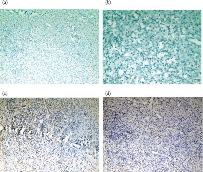 PAX3 Antibody in Immunohistochemistry (IHC)