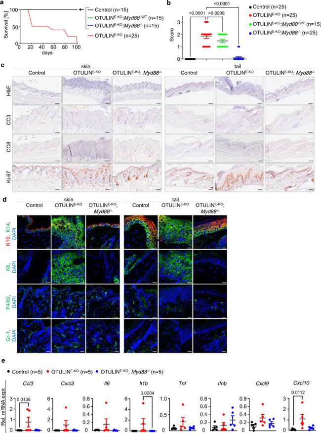 Cytokeratin 14 Antibody in Immunohistochemistry (IHC)