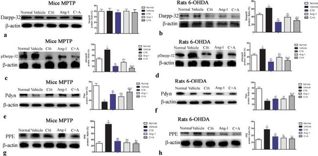 DARPP-32 Antibody in Western Blot (WB)