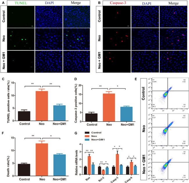 Caspase 3 Antibody in Immunocytochemistry (ICC/IF)