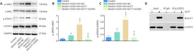 STAT3 Antibody in Western Blot (WB)