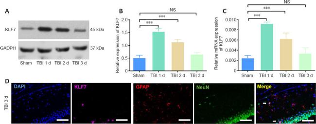 NeuN Antibody in Immunocytochemistry (ICC/IF)