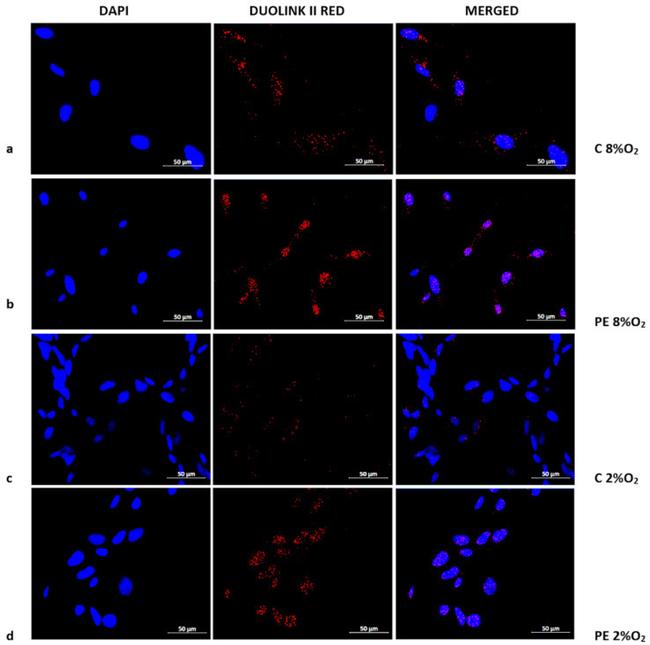 p53 Antibody in Immunocytochemistry (ICC/IF)