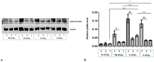 TUBA1A Antibody in Western Blot (WB)