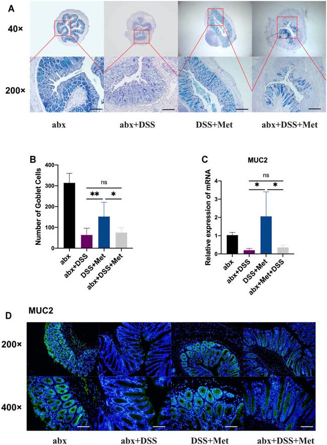 MUC2 Antibody in Immunohistochemistry (Paraffin) (IHC (P))