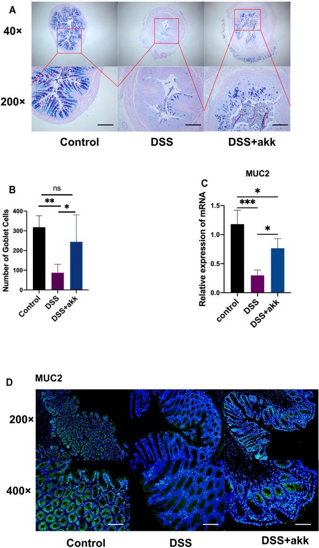 MUC2 Antibody in Immunohistochemistry (Paraffin) (IHC (P))