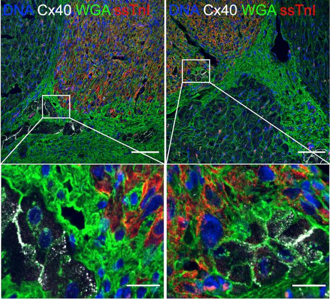 Cardiac Troponin T Antibody in Immunohistochemistry (IHC)