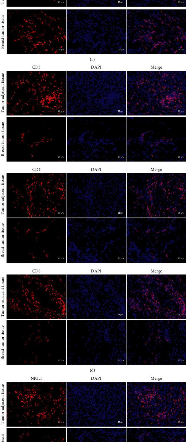 NK1.1 Antibody in Immunohistochemistry (IHC)