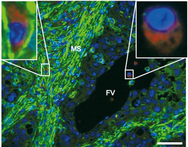 Progesterone Receptor Antibody in Immunohistochemistry (IHC)