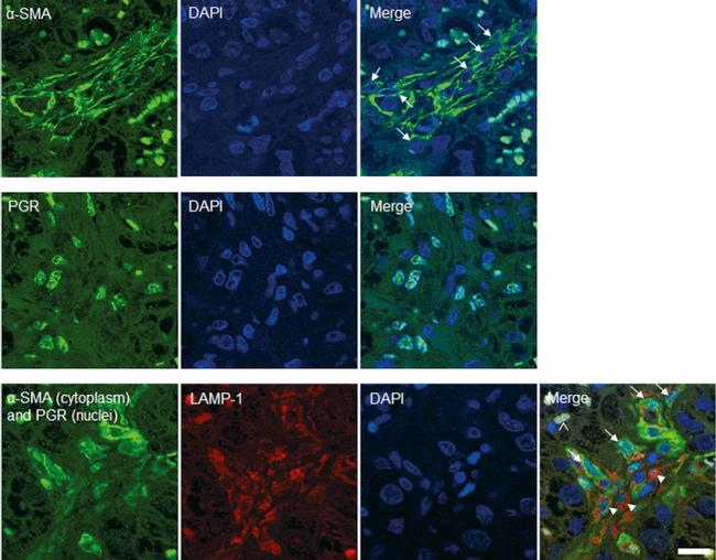 Progesterone Receptor Antibody in Immunocytochemistry (ICC/IF)