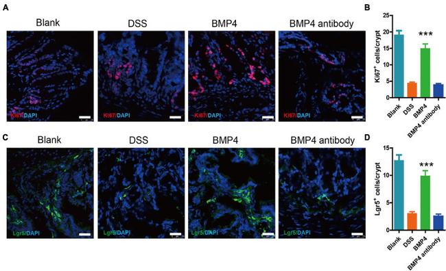 LGR5 Antibody in Immunohistochemistry, Immunohistochemistry (Paraffin) (IHC, IHC (P))