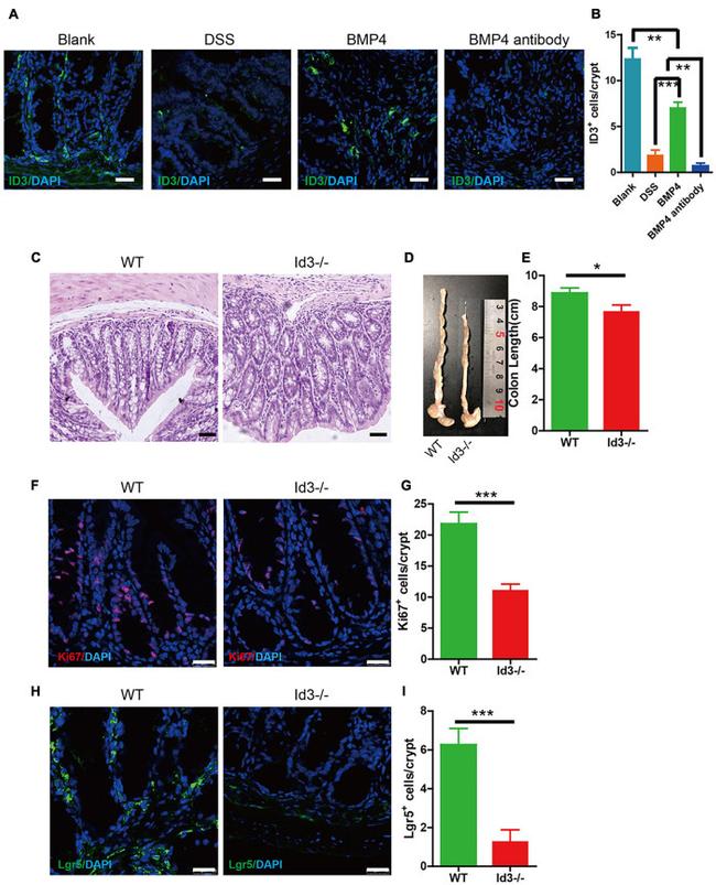 LGR5 Antibody in Immunohistochemistry (Paraffin) (IHC (P))