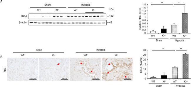 RIG-I Antibody in Western Blot (WB)