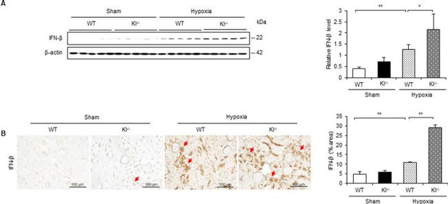 IFN beta Antibody in Western Blot, ELISA (WB, ELISA)