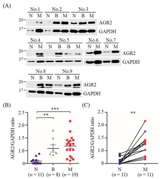 AGR2 Antibody in Western Blot (WB)