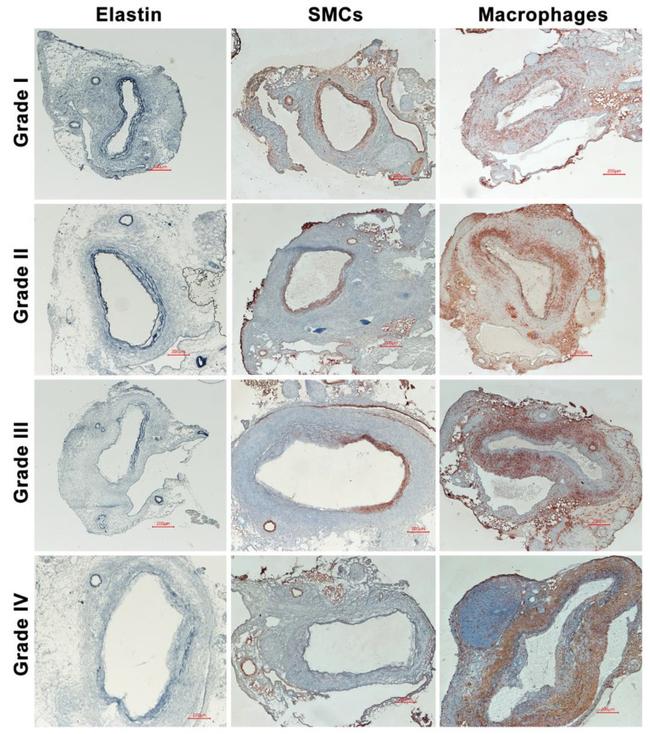 Alpha-Smooth Muscle Actin Antibody in Immunohistochemistry (IHC)