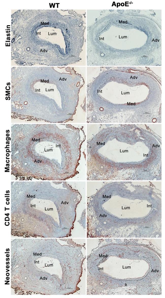 Alpha-Smooth Muscle Actin Antibody in Immunohistochemistry (IHC)