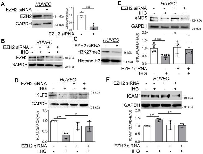 Phospho-EZH2 (Thr367) Antibody in Western Blot (WB)