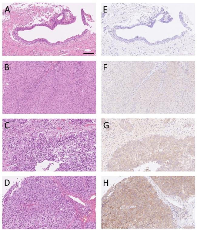 SERPINE2 Antibody in Immunohistochemistry (IHC)