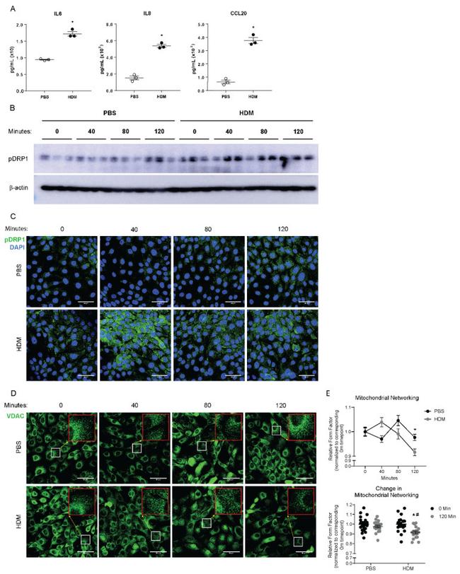 VDAC Antibody in Immunocytochemistry (ICC/IF)