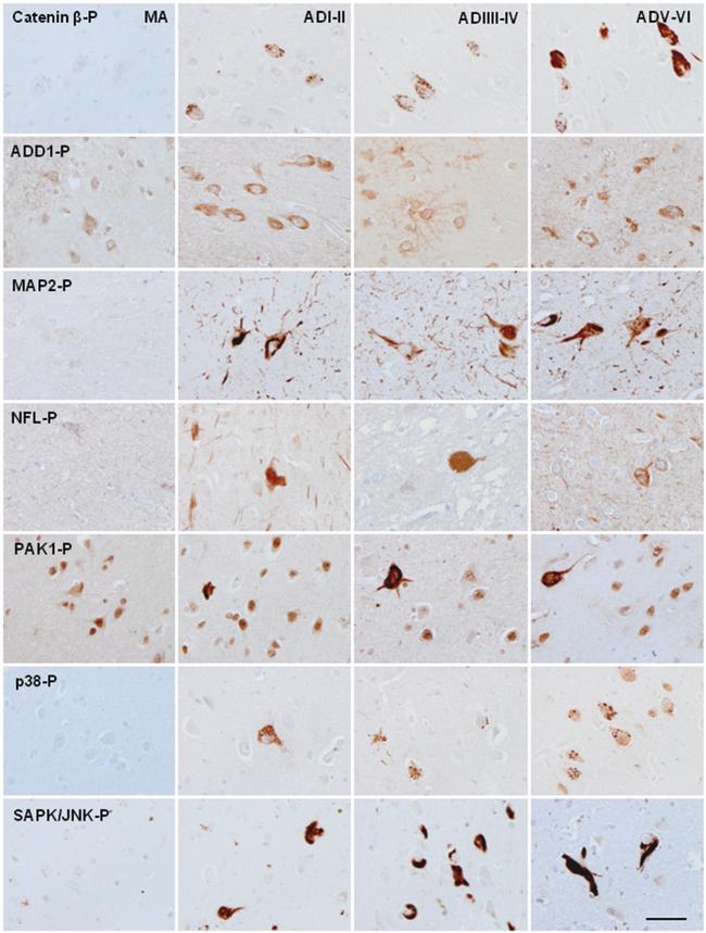 Phospho-ADD1/ADD2 (Ser726, Ser713) Antibody in Immunohistochemistry (IHC)