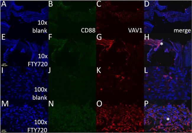 VAV1 Antibody in Immunohistochemistry (IHC)