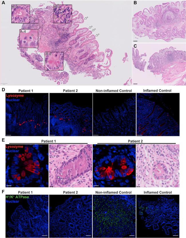 Lysozyme Antibody in Immunohistochemistry (IHC)