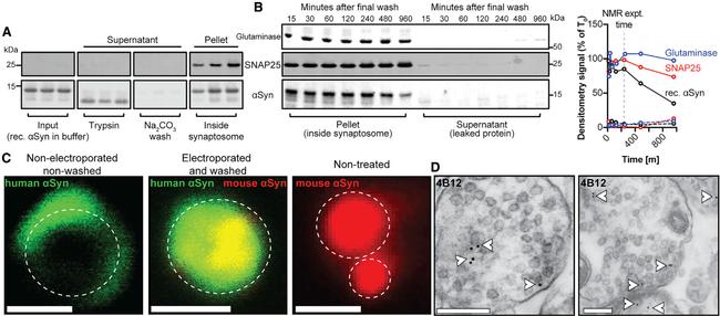 alpha Synuclein Antibody in Western Blot (WB)