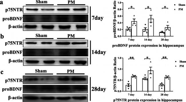 proBDNF Antibody in Western Blot (WB)