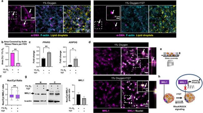 Alpha-Smooth Muscle Actin Antibody in Immunocytochemistry, Immunohistochemistry (ICC/IF, IHC)