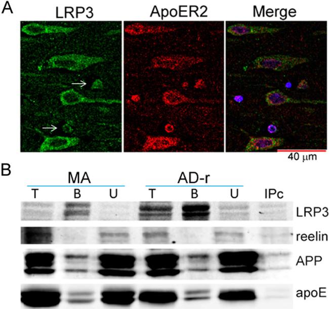 ApoER2 Antibody in Immunocytochemistry, Immunohistochemistry, Immunohistochemistry (Paraffin) (ICC/IF, IHC, IHC (P))