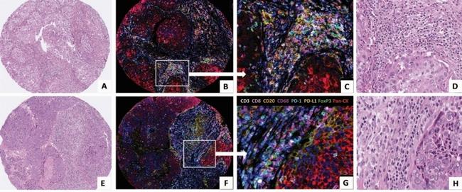 CD8 alpha Antibody in Immunohistochemistry (IHC)