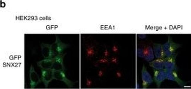 Rabbit IgG (H+L) Cross-Adsorbed Secondary Antibody in Immunocytochemistry (ICC/IF)