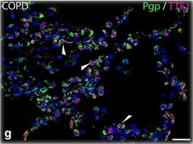 Mouse IgG (H+L) Cross-Adsorbed Secondary Antibody in Immunohistochemistry (IHC)