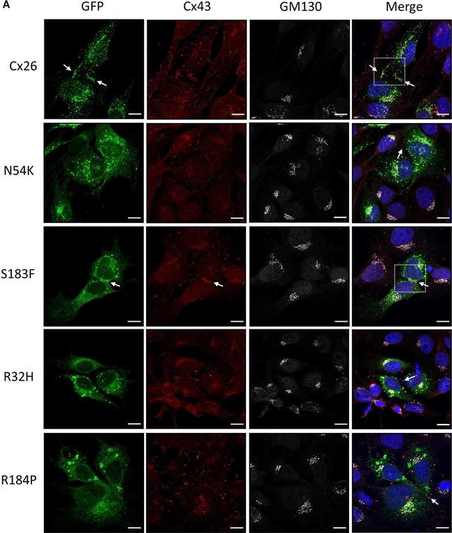 Rabbit IgG (H+L) Highly Cross-Adsorbed Secondary Antibody in Immunocytochemistry (ICC/IF)