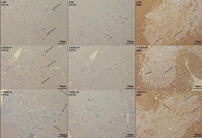 Rat IgG1 Secondary Antibody in Immunohistochemistry (IHC)