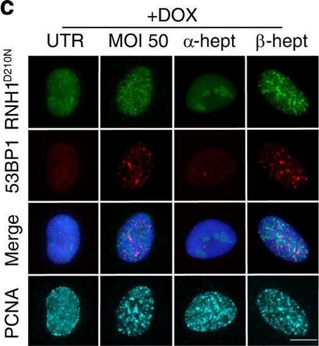 Mouse IgG (H+L) Highly Cross-Adsorbed Secondary Antibody in Immunocytochemistry (ICC/IF)