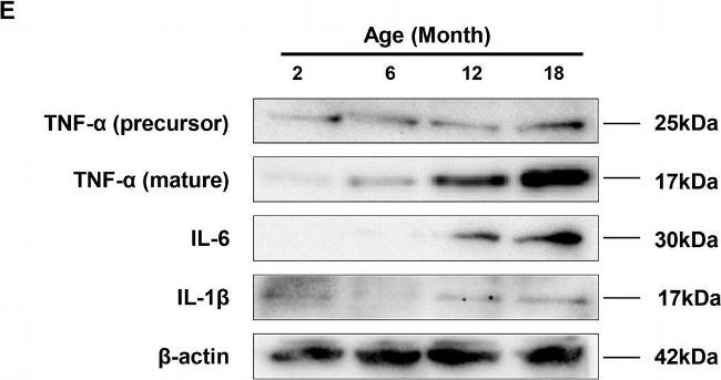 Rabbit IgG (H+L) Secondary Antibody in Western Blot (WB)