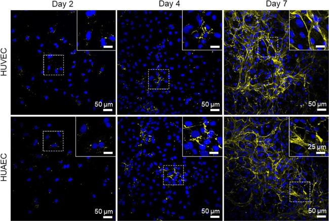 Rabbit IgG (H+L) Cross-Adsorbed Secondary Antibody in Immunocytochemistry (ICC/IF)