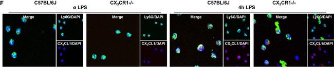 Rabbit IgG (H+L) Cross-Adsorbed Secondary Antibody in Immunocytochemistry (ICC/IF)