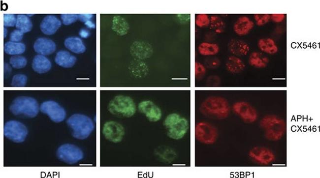 Rat IgG (H+L) Cross-Adsorbed Secondary Antibody in Immunocytochemistry (ICC/IF)