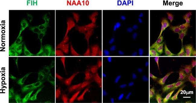 Rat IgG (H+L) Cross-Adsorbed Secondary Antibody in Immunocytochemistry (ICC/IF)