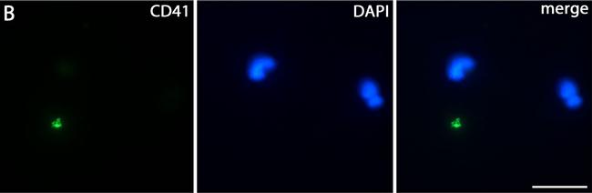 Rat IgG (H+L) Cross-Adsorbed Secondary Antibody in Immunocytochemistry (ICC/IF)