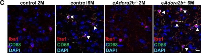 Rabbit IgG (H+L) Cross-Adsorbed Secondary Antibody in Immunohistochemistry (IHC)