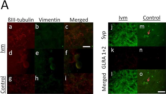 Mouse IgG (H+L) Cross-Adsorbed Secondary Antibody in Immunocytochemistry (ICC/IF)