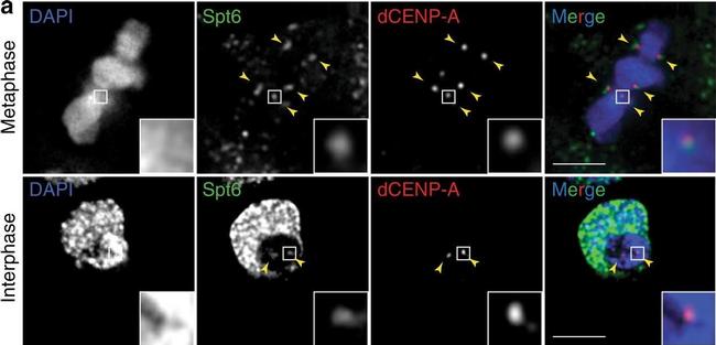 Chicken IgY (H+L) Secondary Antibody in Immunocytochemistry (ICC/IF)