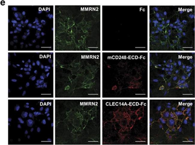 Human IgG (H+L) Cross-Adsorbed Secondary Antibody in Immunocytochemistry (ICC/IF)