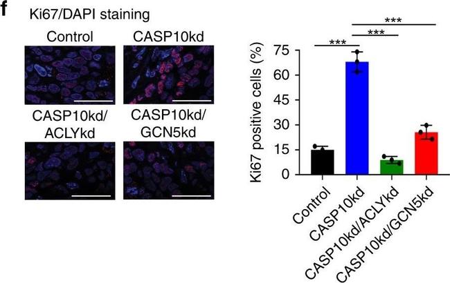 Rabbit IgG (H+L) Cross-Adsorbed Secondary Antibody in Immunohistochemistry (Paraffin) (IHC (P))